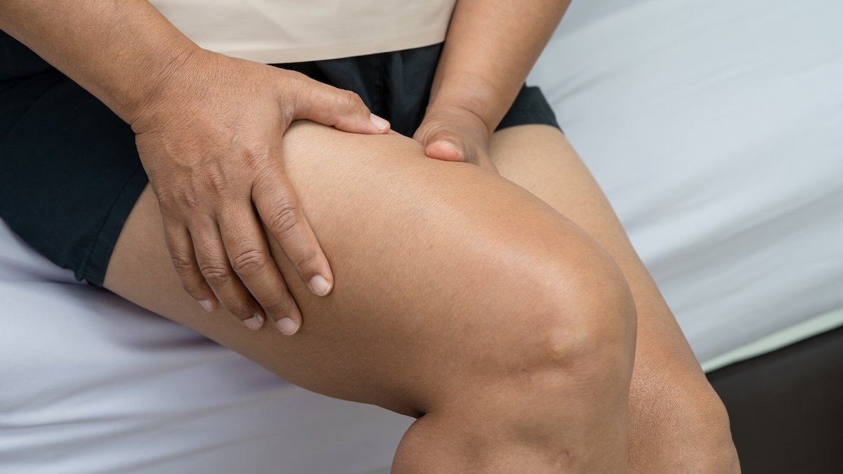 Selülit yanılgısı lipödem tedavisini geciktiriyor